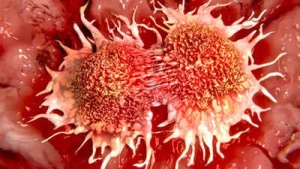 Vitamin C Deficiency Linked to Increased Risk of Stomach, Esophageal, and Lung Cancers: Know the Signs