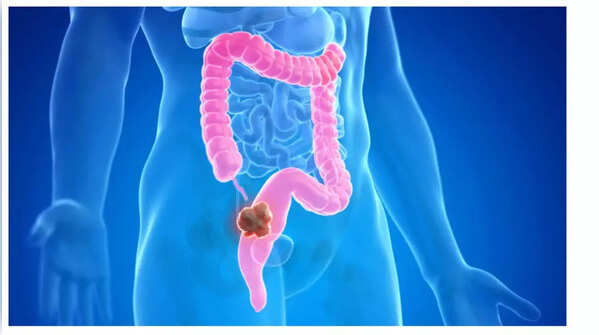 Illustration of weight loss.